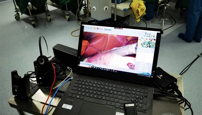 Grampeadores cirúrgicos CAK brilham em seis cirurgias ao vivo em toda a China